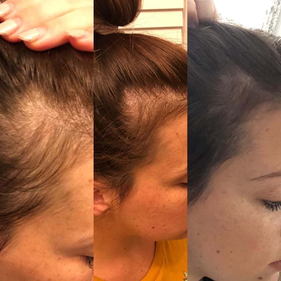 PRE ORDER: Anointed Growth Oil: Hair Growth