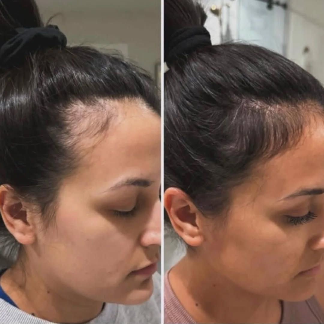 PRE ORDER: Anointed Growth Oil: Hair Growth