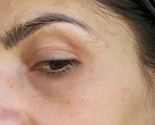 OJERAS